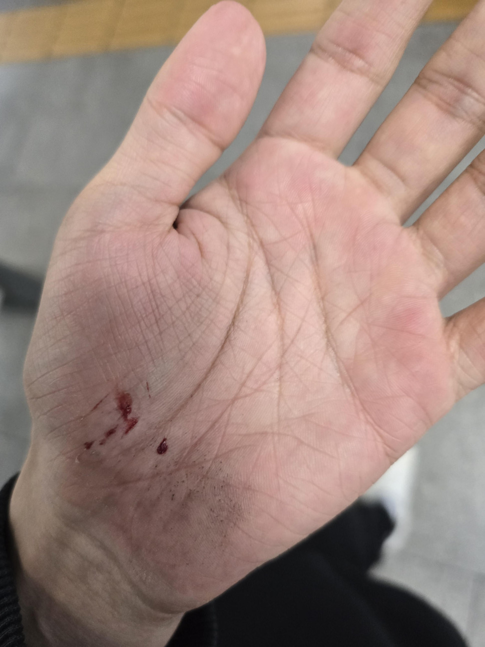 1743461873421.jpg : 네흥이 노래 들으면서 뛰댕기다 넘어짐 ㅠㅠ 1743461873421.jpg : 네흥이 노래 들으면서 뛰댕기다 넘어짐 ㅠㅠ